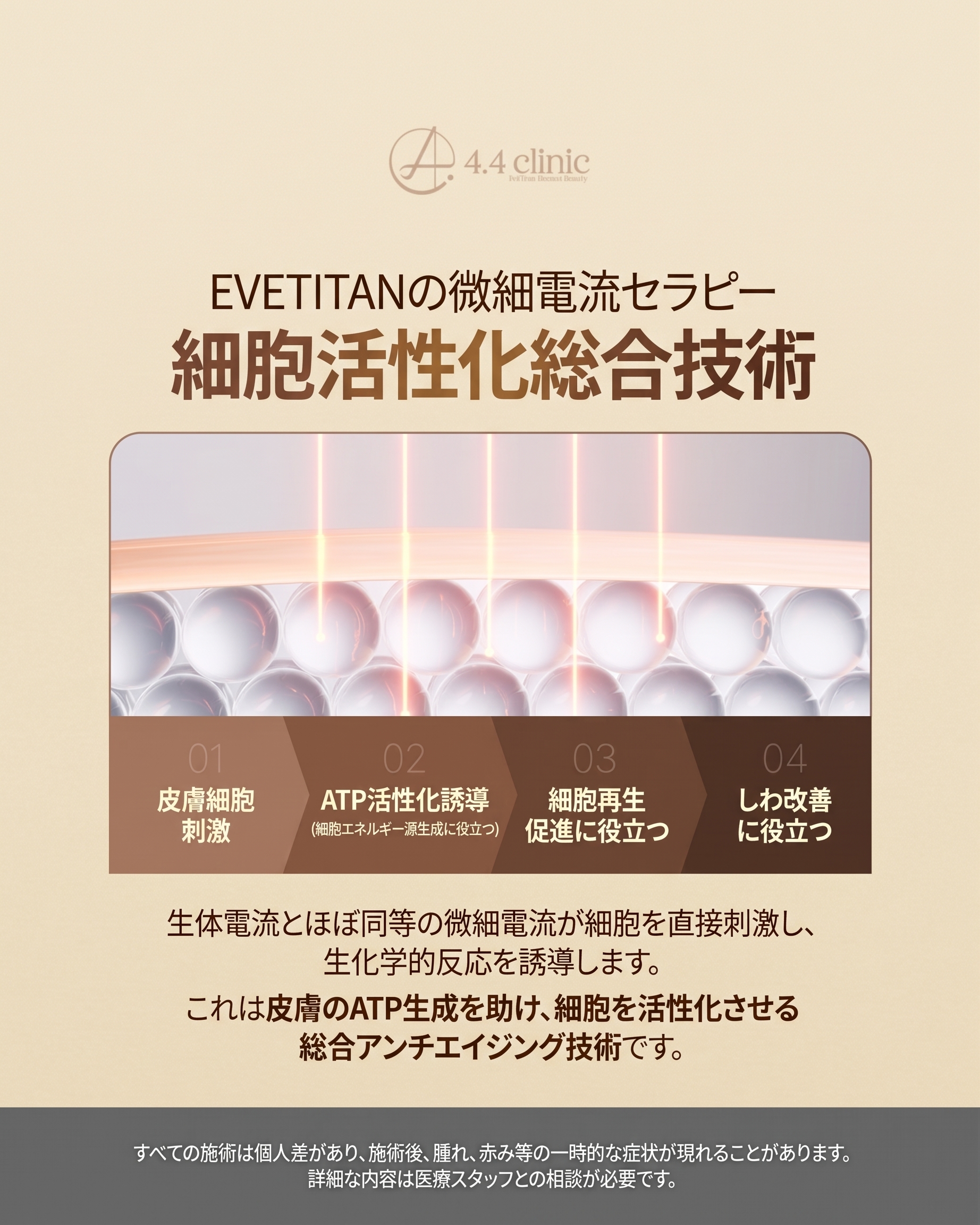 イブタイタン (Eve Titan) リフティング:「弾力」デザイン(レーザーリフティング深層分析) 사진 2