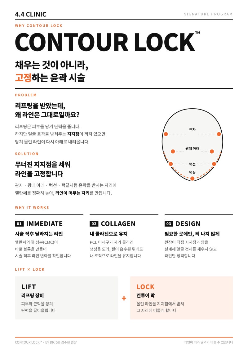 리프팅 후 라인이 다시 무너지는 이유, 엘란쎄 윤곽고정술 컨투어락(CONTOUR LOCK™) | 청담 4.4 CLINIC 사진 4